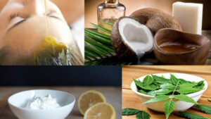 علاج قشرة الشعر في المنزل